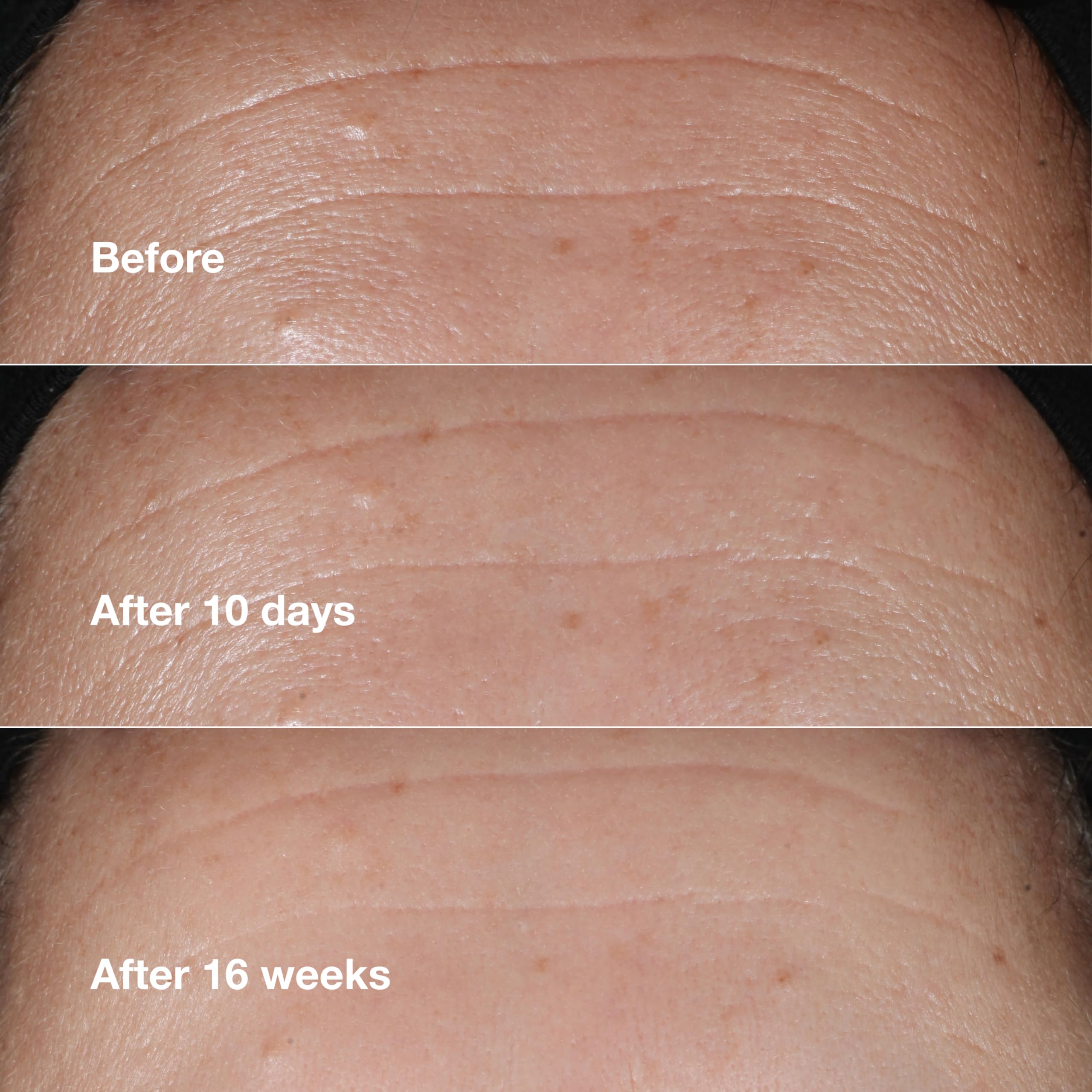 1787522397_CHbLc7gq Smart Clinical Repair Anti-aging Face Serum