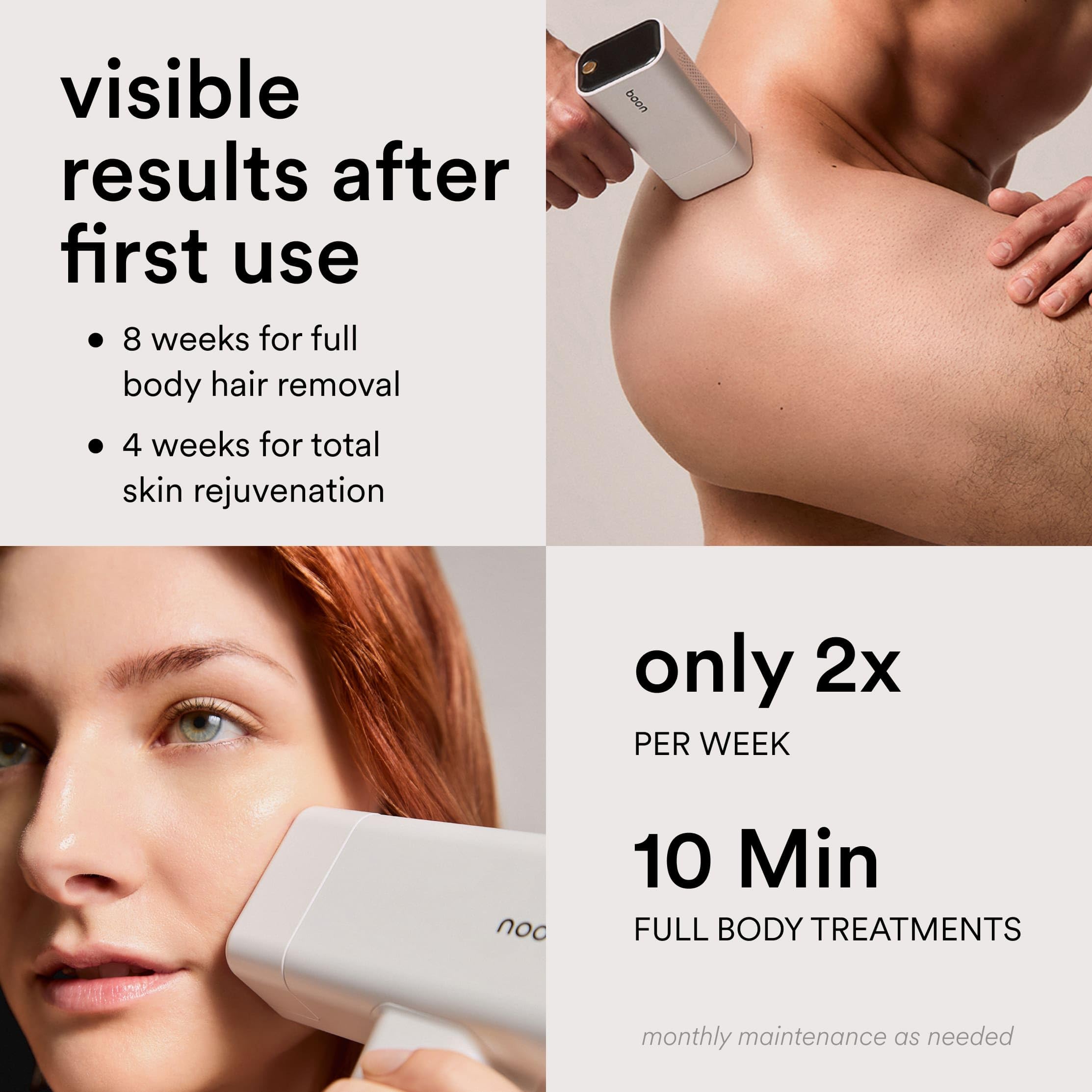 1787543234_Voe04mSw Flasher Pro IPL Laser włosów Removal Device